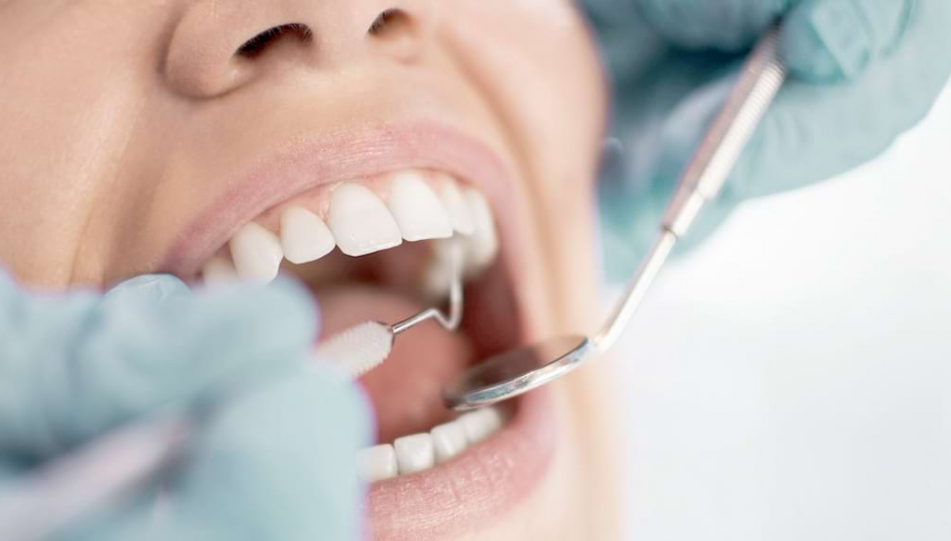Zahnbehandlung Detail